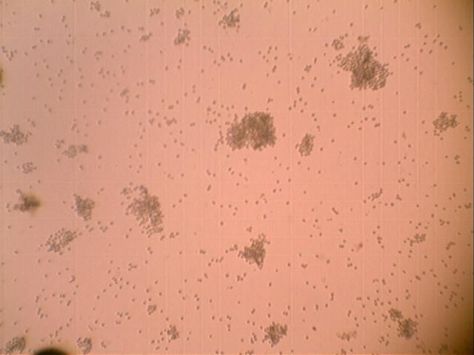 24_Дрожжи из пива