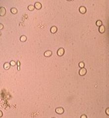 Главное брожение